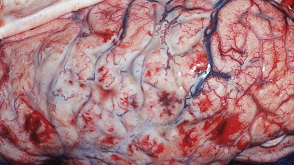 lyme disease in horses brain